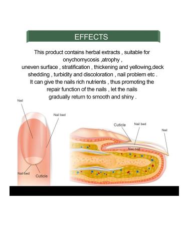 Nail care fluid (50 ml) - Buy Online on GoSupps.com