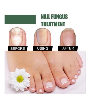 Nail care fluid (50 ml) - Buy Online on GoSupps.com