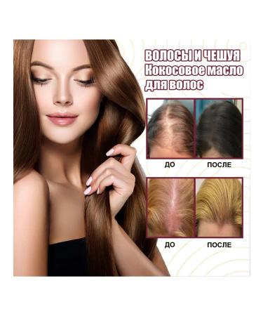 Ouhoe Hair growth Essential oil onions nourishes the scalp 30 ml - Buy Online on GoSupps.com