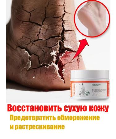 Restore dry skin to restore the arms and legs