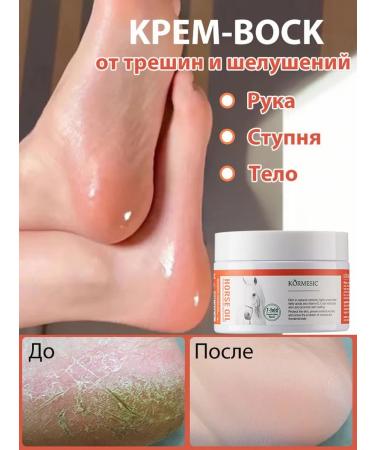 Restore dry skin to restore the arms and legs - Buy Online on GoSupps.com