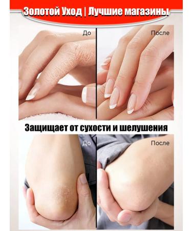 Restore dry skin to restore the arms and legs - Buy Online on GoSupps.com