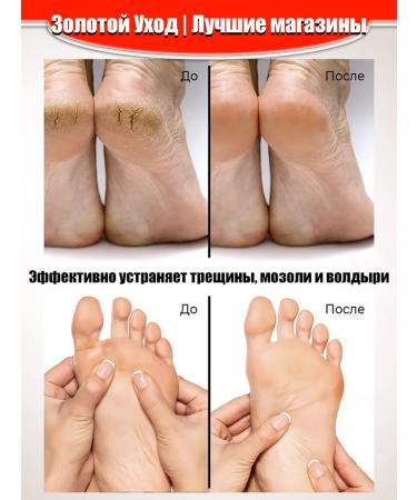 Restore dry skin to restore the arms and legs - Buy Online on GoSupps.com