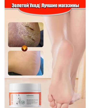 Restore dry skin to restore the arms and legs - Buy Online on GoSupps.com