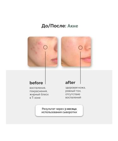 Anua Caling ampoule Heartleaf 80% Moisture Soothing - Buy Online on GoSupps.com