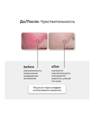 Anua Caling ampoule Heartleaf 80% Moisture Soothing - Buy Online on GoSupps.com