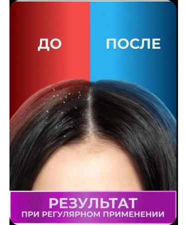 Head & Shoulders Set of menthol shampoos 2 in 1-6 pcs - Buy Online on GoSupps.com