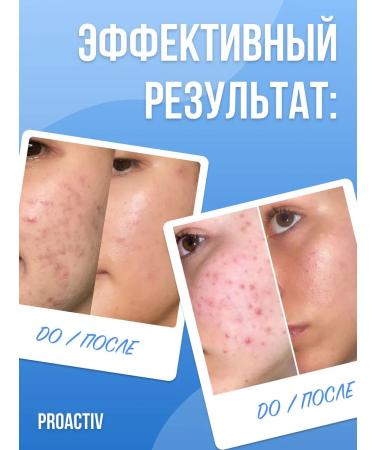 Proactiv Cosmetic kit against acne - scrub tonic and gel - Buy Online on GoSupps.com