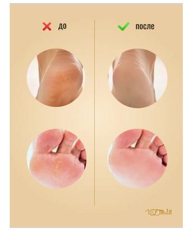 Cosmiso Cream wax from cracks for very dry skin and legs - Buy Online on GoSupps.com