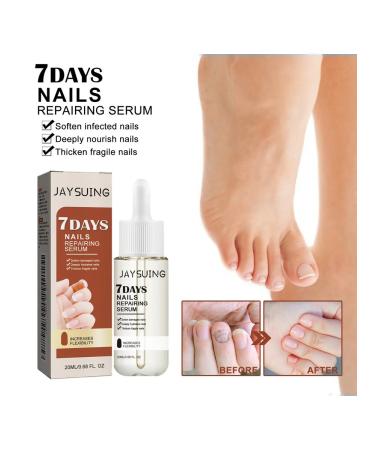 JaySuing Essence to cleanse gray nails 2 pcs - Buy Online on GoSupps.com