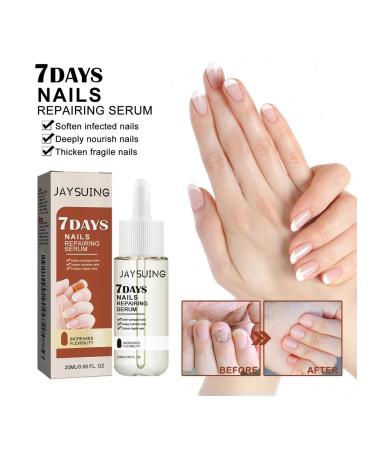 JaySuing Essence to cleanse gray nails 2 pcs - Buy Online on GoSupps.com