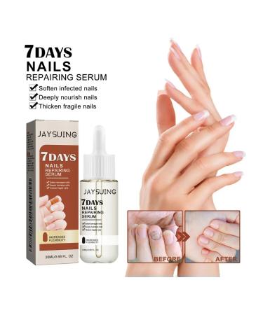JaySuing Essence to cleanse gray nails 2 pcs - Buy Online on GoSupps.com