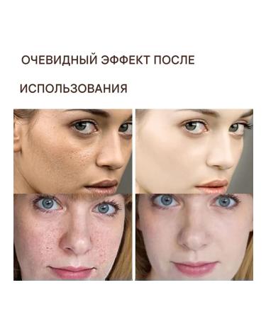eelhoe anti -aging face cream smoothes the wrinkle pulling the skin - Buy Online on GoSupps.com