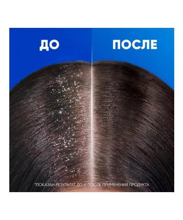 Head and Shoulders Anti-dandruff shampoo and hair conditioner 2-in-1 1000 ml with dispenser - Buy Online on GoSupps.com