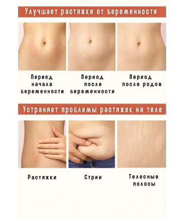 Stretch mark cream for pregnant women - Buy Online on GoSupps.com