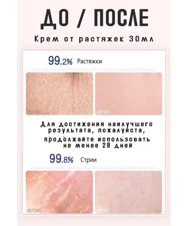 Stretch mark cream for pregnant women - Buy Online on GoSupps.com