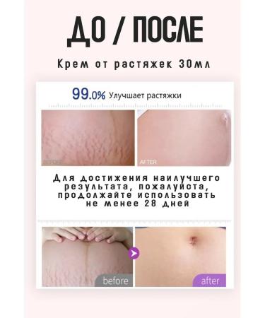 Stretch mark cream for pregnant women - Buy Online on GoSupps.com