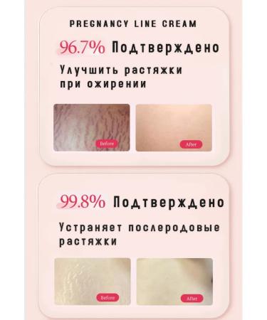Stretch mark cream for pregnant women - Buy Online on GoSupps.com