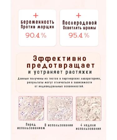 Stretch mark cream for pregnant women - Buy Online on GoSupps.com
