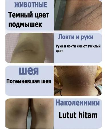 Cream for bleaching intimate parts of the body - Buy Online on GoSupps.com