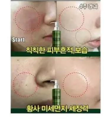 MediPeel Algo-tox Deep Clear gel for washing - Buy Online on GoSupps.com