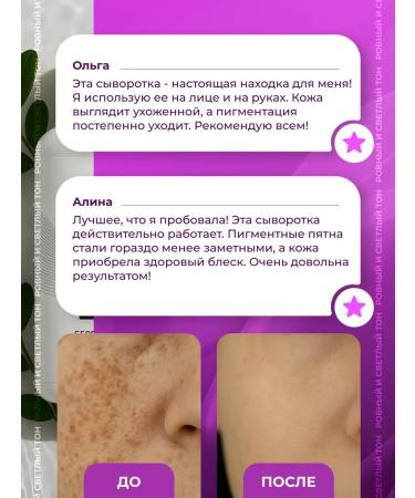 Lucas LV Cream whitening for the face and body set - Buy Online on GoSupps.com