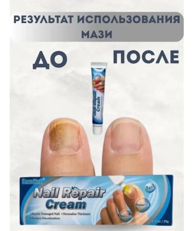 SLana Ointment for nail fungus - Buy Online on GoSupps.com
