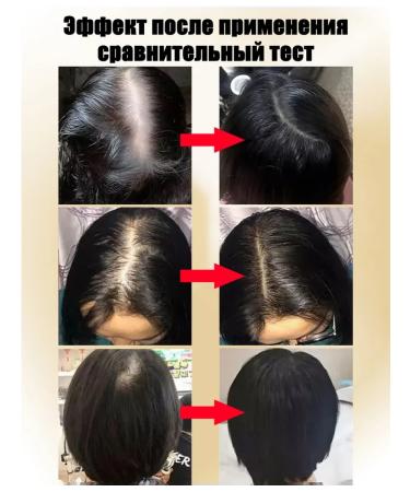 LYDIMOON Ginger shampoo nutrient 300 ml from hair loss - Buy Online on GoSupps.com