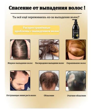 LYDIMOON Ginger shampoo nutrient 300 ml from hair loss - Buy Online on GoSupps.com