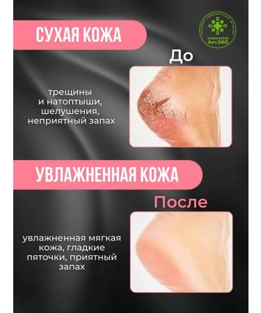 Caucasian Pharmacy Cream wax from cracks and dryness for heels and body - Buy Online on GoSupps.com