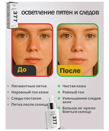 Clarifying cream from pigmentation - Buy Online on GoSupps.com