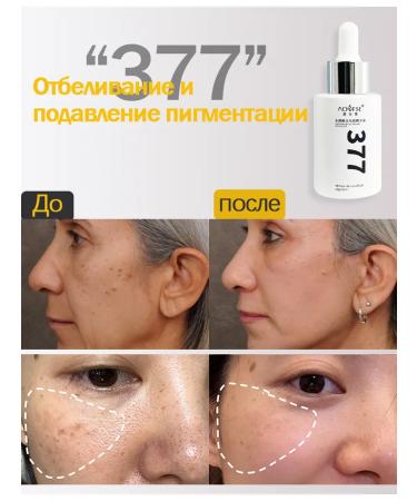 Clarifying cream from pigmentation - Buy Online on GoSupps.com