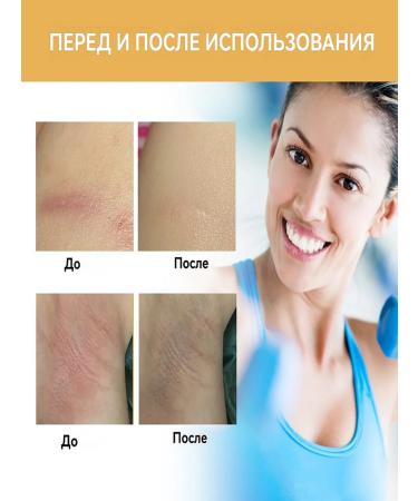 Antiflication cream for the body of the joints moisturizes the skin - Buy Online on GoSupps.com