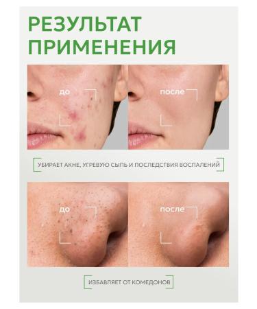ARKADA LAVVEX Anti-acne whey against acne acne problem skin - Buy Online on GoSupps.com