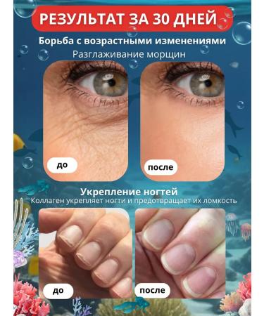 Jinskin Sea collagen jelly in sticks 20 pcs - Buy Online on GoSupps.com