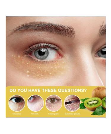 Korean cosmetics Cream from milias from a sourdough white acne and horn cysts - Buy Online on GoSupps.com