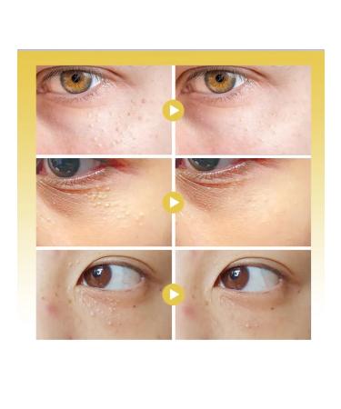 Korean cosmetics Cream from milias from a sourdough white acne and horn cysts - Buy Online on GoSupps.com