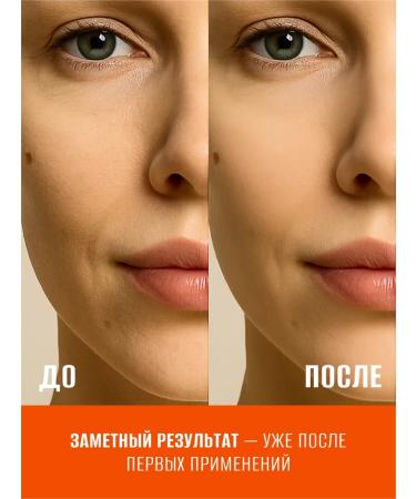 Eskin Touch Facial serum with vitamin C against pigmentation 50ML - Buy Online on GoSupps.com