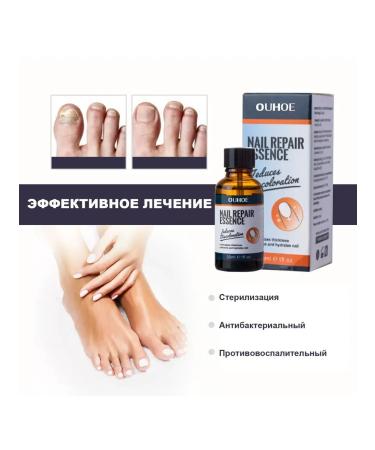 Ouhoe Restore damaged nails the essence to remove fungi - Buy Online on GoSupps.com