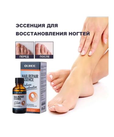 Ouhoe Restore damaged nails the essence to remove fungi - Buy Online on GoSupps.com