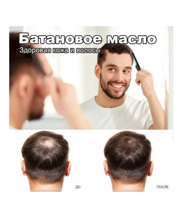 Ouhoe Promotes hair growth with essential oil prevent the fall - Buy Online on GoSupps.com