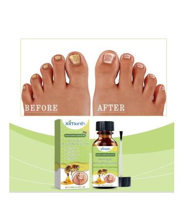 Nail care restoring cream 15 ml