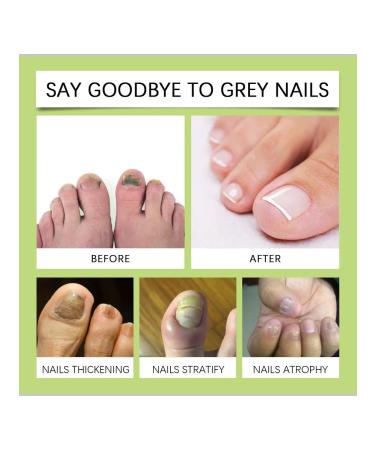 Nail care restoring cream 15 ml - Buy Online on GoSupps.com