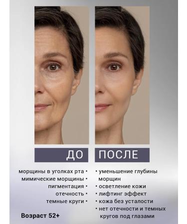 PixelTap Beauty Carboxytherapy for face 2 in 1 effect of Botox - Buy Online on GoSupps.com