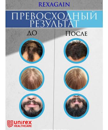 Unirex Healthcare Lotion 5% activator for hair growth and beard - Buy Online on GoSupps.com