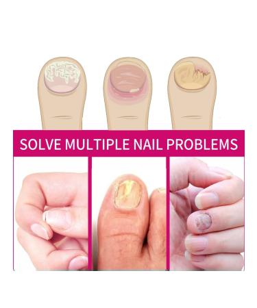 OUHOE Ginger Care for nails Essence - Buy Online on GoSupps.com