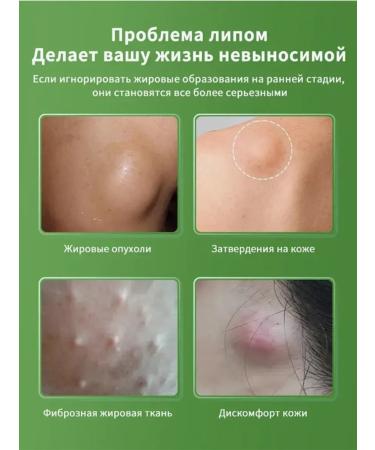 Ointment from Lipoma and Girovikov Chinese 55 g - Buy Online on GoSupps.com
