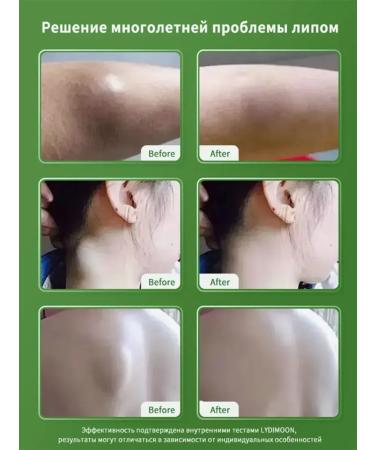 Ointment from Lipoma and Girovikov Chinese 55 g - Buy Online on GoSupps.com