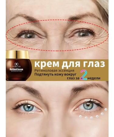 LYDIMOON Skin cream around the eyes with retinol and serum 35 g