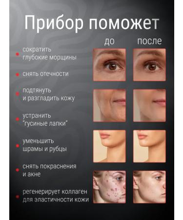 LUXLIFTING Microotokoma massager for faces from wrinkles and edema of the Russian Federation Lifting - Buy Online on GoSupps.com